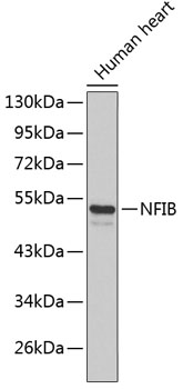 Western blot - NFIB Polyclonal Antibody 