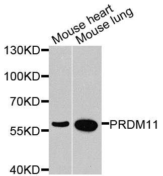 Western blot - PRDM11 Polyclonal Antibody 