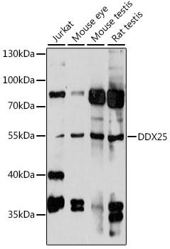 Western blot - DDX25 Polyclonal Antibody 