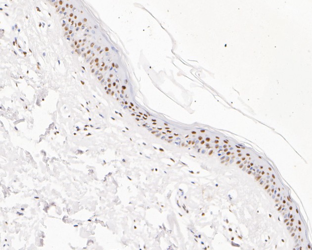 Fig5:; Immunohistochemical analysis of paraffin-embedded human skin tissue using anti-GATAD2A antibody. The section was pre-treated using heat mediated antigen retrieval with sodium citrate buffer (pH 6.0) for 20 minutes. The tissues were blocked in 5% BSA for 30 minutes at room temperature, washed with ddH; 2; O and PBS, and then probed with the primary antibody ( 1/200) for 30 minutes at room temperature. The detection was performed using an HRP conjugated compact polymer system. DAB was used as the chromogen. Tissues were counterstained with hematoxylin and mounted with DPX.