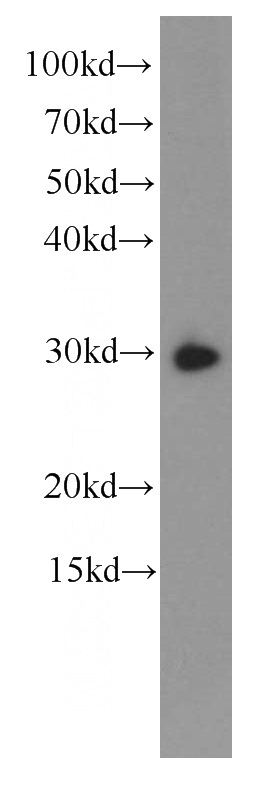 Jurkat cells were subjected to SDS PAGE followed by western blot with Catalog No:107402(IL6 antibody) at dilution of 1:1000
