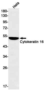 Western blot detection of Cytokeratin 16 in Hela cell lysates using Cytokeratin 16 Rabbit mAb(1:1000 diluted).Predicted band size:51kDa.Observed band size:51kDa.