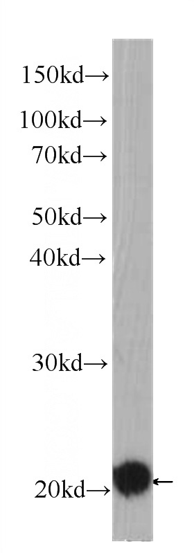 HeLa cells were subjected to SDS PAGE followed by western blot with Catalog No:107018(BID Antibody) at dilution of 1:1000