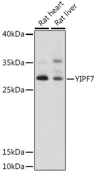 Western blot - YIPF7 Polyclonal Antibody 