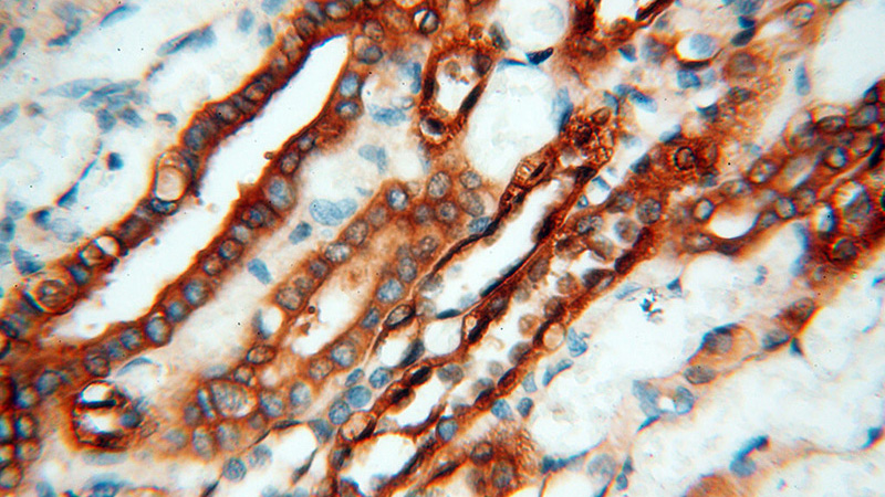Immunohistochemical of paraffin-embedded human kidney using Catalog No:112705(MMP28 antibody) at dilution of 1:100 (under 40x lens)