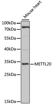 Western blot - METTL20 Polyclonal Antibody 