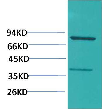 Western blot analysis of HepG2 with PI3 Kinase p85u03b1 Rabbit pAb  diluted at 1:2,000.