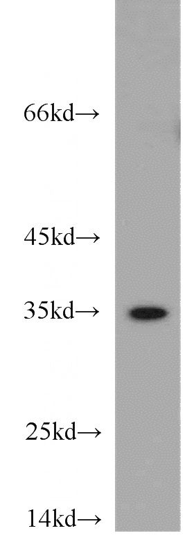 Jurkat cells were subjected to SDS PAGE followed by western blot with Catalog No:114381(PSMB11 antibody) at dilution of 1:300