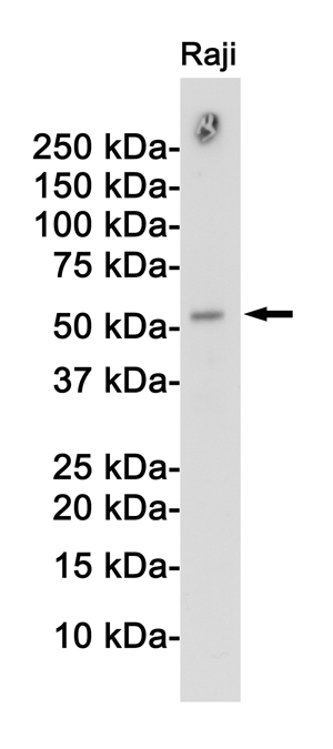 Western blot detection of Atg5/Apg5L in Raji cell lysates using Atg5/Apg5L Rabbit pAb(1:1000 diluted).Predicted band size:33KDa.Observed band size:55KDa.