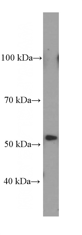 human stomach tissue were subjected to SDS PAGE followed by western blot with Catalog No:107030(CA9 Antibody) at dilution of 1:1000