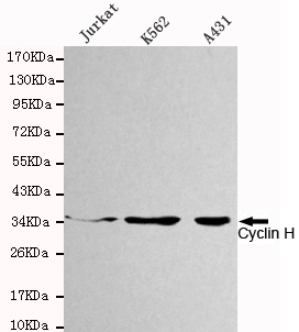 Western blot detection of Cyclin H in Jurkat,K562 and A431 cell lysates using Cyclin H mouse mAb (1:1000 diluted).Predicted band size: 38KDa.Observed band size: 38KDa.