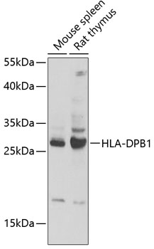 Western blot - HLA-DPB1 Polyclonal Antibody 