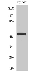 Fig1:; Western Blot analysis of various cells using V-ATPase H Polyclonal Antibody. Secondary antibody（catalog#: HA1001) was diluted at 1:20000