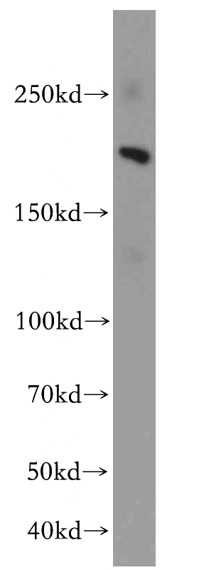 HeLa cells were subjected to SDS PAGE followed by western blot with Catalog No:112026(KDM3B antibody) at dilution of 1:500