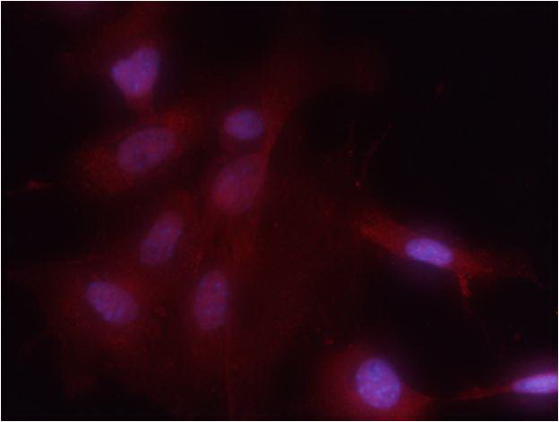 Immunofluorescence staining of methanol-fixed MEF cells using NF-κB p65 (Phospho-Ser536) Antibody .
