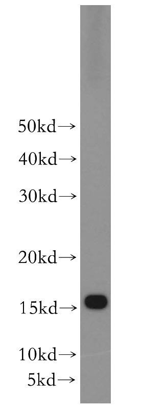MCF7 cells were subjected to SDS PAGE followed by western blot with Catalog No:114833(RPS20 antibody) at dilution of 1:500