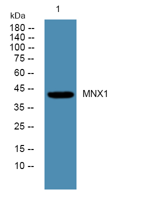 Fig1:; Western blot analysis of lysates from SW480 cells, primary antibody was diluted at 1:1000, 4°over night.