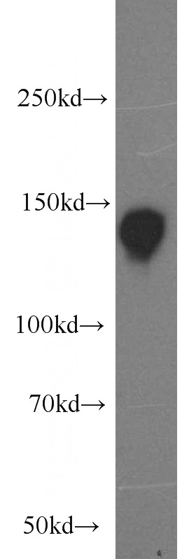 HeLa cells were subjected to SDS PAGE followed by western blot with Catalog No:113023(NBR1 antibody) at dilution of 1:1500