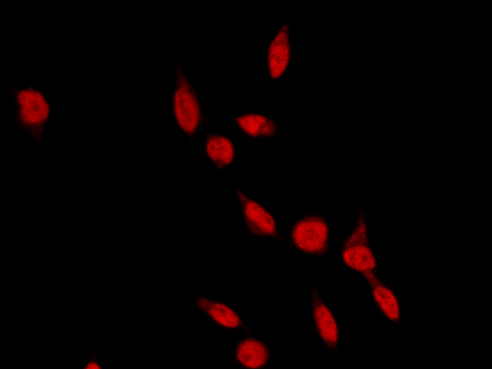 RAD18 Antibody, Rabbit PAb, Antigen Affinity Purified, Immunofluorescence