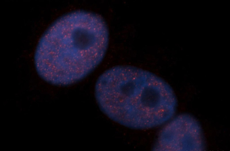 Immunofluorescent analysis of A549 cells, using CHD4 antibody Catalog No:109220 at 1:50 dilution and Rhodamine-labeled goat anti-rabbit IgG (red). Blue pseudocolor = DAPI (fluorescent DNA dye).