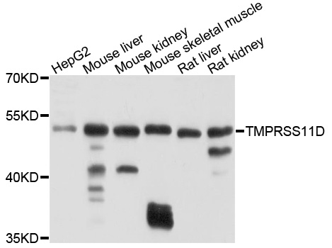 Western blot - TMPRSS11D Polyclonal Antibody 