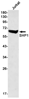 Western blot detection of SHP1 in Jurkat cell lysates using SHP1 Rabbit mAb(1:500 diluted).Predicted band size:68kDa.Observed band size:68kDa.