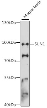 Western blot - SUN1 Polyclonal Antibody 