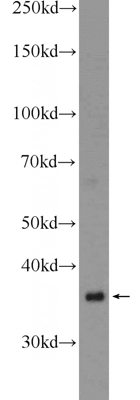 human testis tissue were subjected to SDS PAGE followed by western blot with Catalog No:116848(WBP2NL Antibody) at dilution of 1:600
