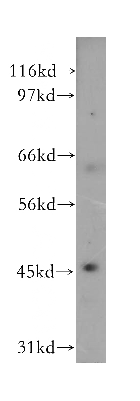 Y79 cells were subjected to SDS PAGE followed by western blot with Catalog No:112241(LIPA antibody) at dilution of 1:400