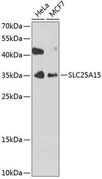 Western blot - SLC25A15 Polyclonal Antibody 