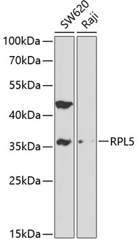 Western blot - RPL5 Polyclonal Antibody 