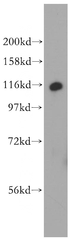 human adrenal gland tissue were subjected to SDS PAGE followed by western blot with Catalog No:112783(MTMR14 antibody) at dilution of 1:500