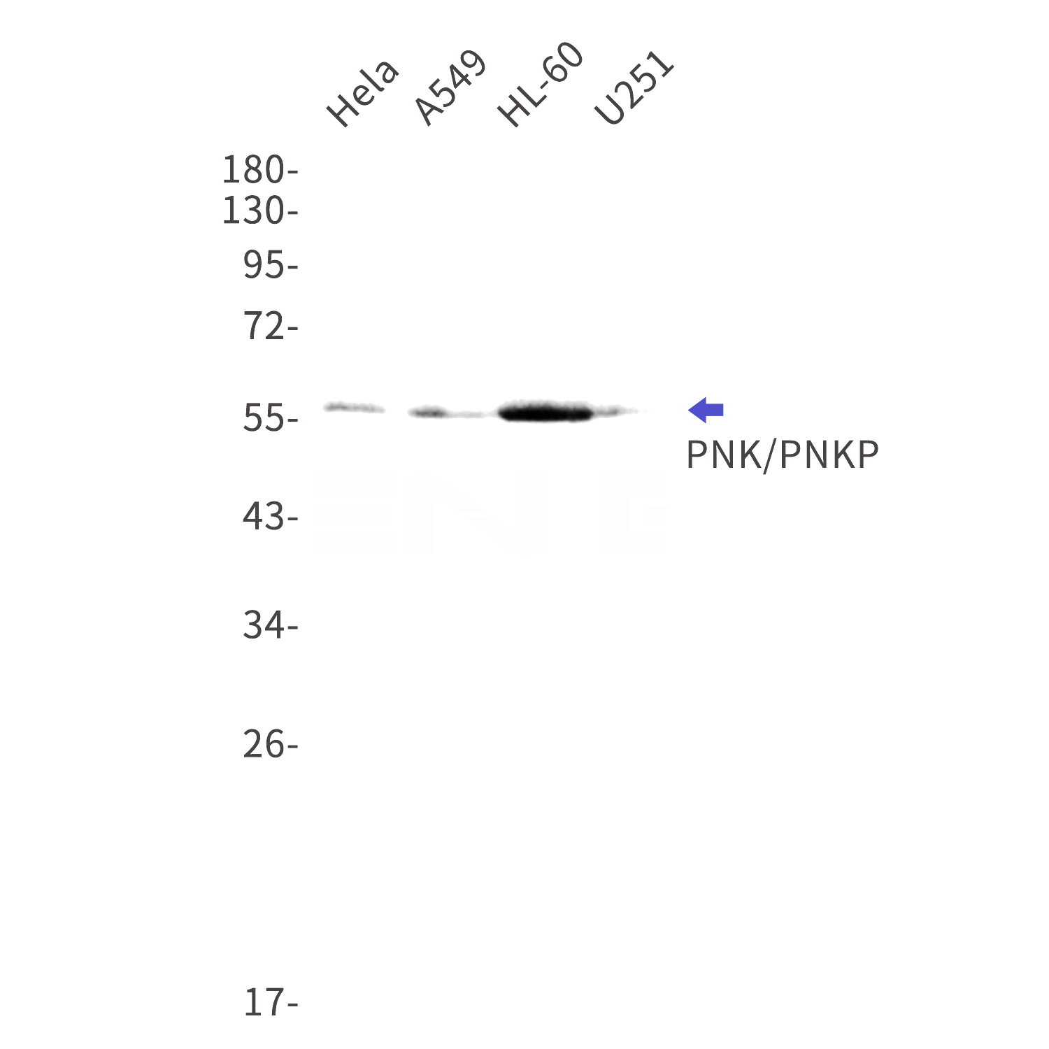 Western blot detection of PNK/PNKP in Hela,A549,HL-60,U251cell lysates using PNK/PNKP Rabbit mAb(1:1000 diluted).Predicted band size:57kDa.Observed band size:57kDa.