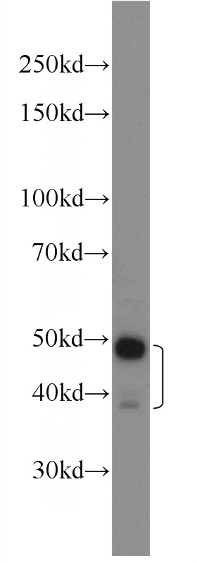 HeLa cells were subjected to SDS PAGE followed by western blot with Catalog No:114853(RSRC1 Antibody) at dilution of 1:1500