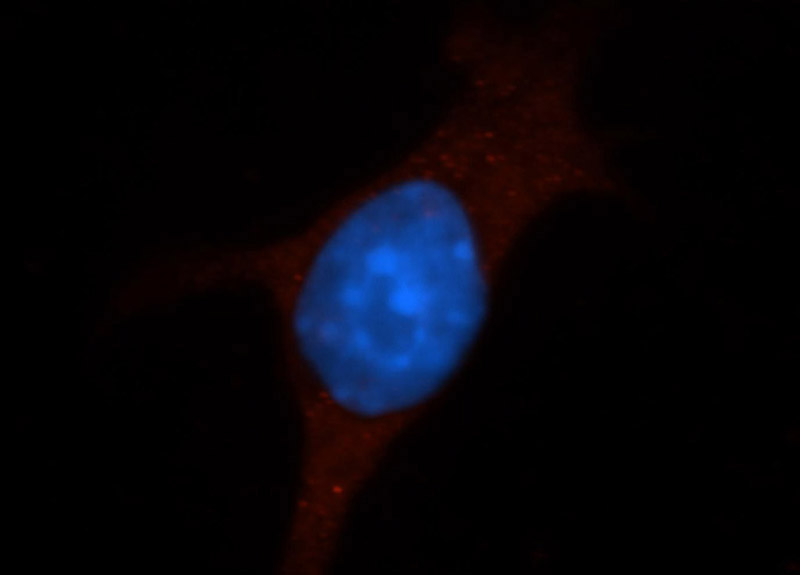 Immunofluorescent analysis of 4T1 cells, using ICAM-1 antibody Catalog No:111588 at 1:50 dilution and FITC-labeled donkey anti-rabbit IgG (red). Blue pseudocolor = DAPI (fluorescent DNA dye).