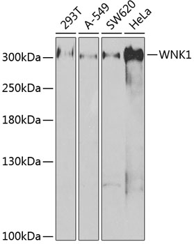 Western blot - WNK1 Polyclonal Antibody 