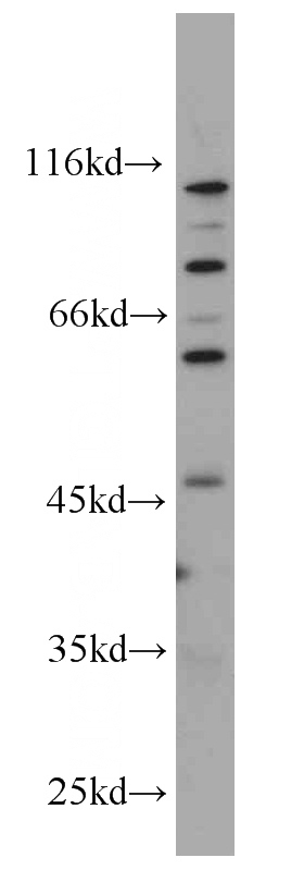 HeLa cells were subjected to SDS PAGE followed by western blot with Catalog No:107450(PAIP1 antibody) at dilution of 1:1000