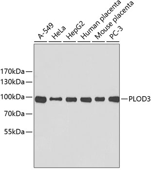 Western blot - PLOD3 Polyclonal Antibody 