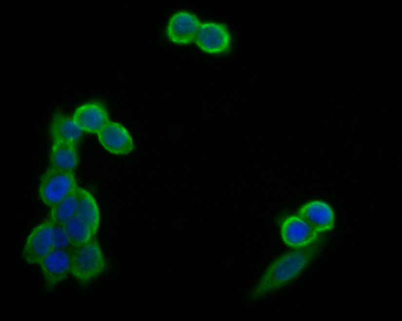 Fig2:; ICC staining of GM648 in 293T cells (green). Formalin fixed cells were permeabilized with 0.1% Triton X-100 in TBS for 10 minutes at room temperature and blocked with 1% Blocker BSA for 15 minutes at room temperature. Cells were probed with the primary antibody ( 1/50) for 1 hour at room temperature, washed with PBS. Alexa Fluor®488 Goat anti-Rabbit IgG was used as the secondary antibody at 1/1,000 dilution. The nuclear counter stain is DAPI (blue).
