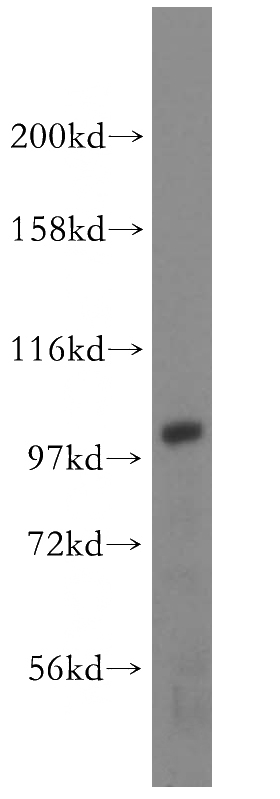 HEK-293 cells were subjected to SDS PAGE followed by western blot with Catalog No:108115(AP1B1 antibody) at dilution of 1:500