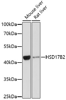 Western blot - HSD17B2 Polyclonal Antibody 