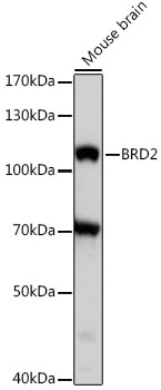 Western blot - BRD2 Polyclonal Antibody 