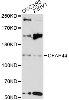 Western blot - CFAP44 Polyclonal Antibody 