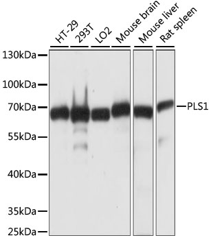 Western blot - PLS1 Polyclonal Antibody 