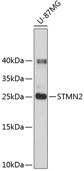Western blot - STMN2 Polyclonal Antibody 