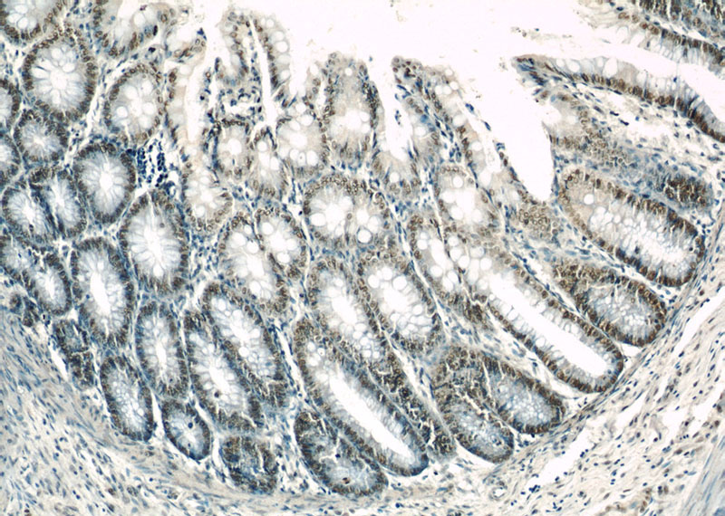 Immunohistochemical of paraffin-embedded human colon using Catalog No:111092(N-PAC antibody) at dilution of 1:50 (under 10x lens)