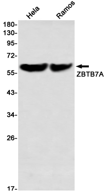 Western blot detection of ZBTB7A in Hela,Ramos using ZBTB7A Rabbit mAb(1:1000 diluted)