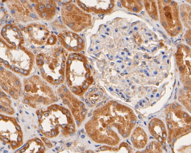 Fig5:; Immunohistochemical analysis of paraffin-embedded human kidney tissue using anti-NHE-1 antibody. The section was pre-treated using heat mediated antigen retrieval with Tris-EDTA buffer (pH 8.0-8.4) for 20 minutes.The tissues were blocked in 5% BSA for 30 minutes at room temperature, washed with ddH; 2; O and PBS, and then probed with the primary antibody ( 1/50) for 30 minutes at room temperature. The detection was performed using an HRP conjugated compact polymer system. DAB was used as the chromogen. Tissues were counterstained with hematoxylin and mounted with DPX.