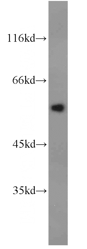 human blood tissue were subjected to SDS PAGE followed by western blot with Catalog No:108107(SERPINC1 antibody) at dilution of 1:300