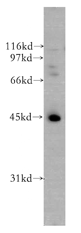 A431 cells were subjected to SDS PAGE followed by western blot with Catalog No:116533(UBE2Q2 antibody) at dilution of 1:400